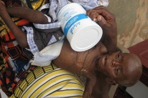 Bébé Valérie stupéfaite - Centre de Ndelele au CAMEROUN